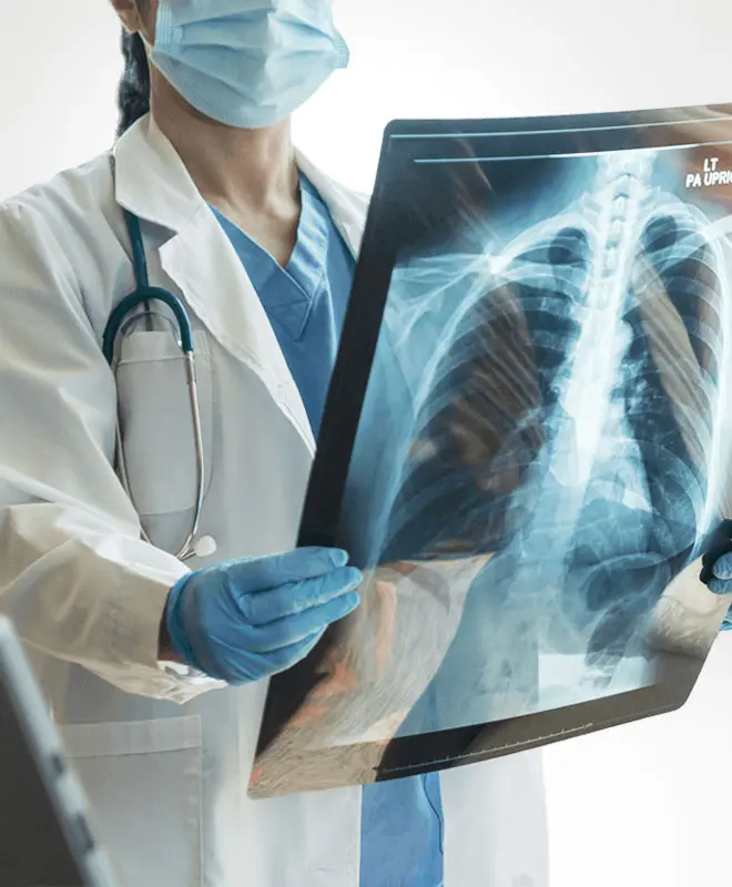 Doctor examining an X-Ray | Musculoskeletal Conditions | Internal Medicine Prime Care